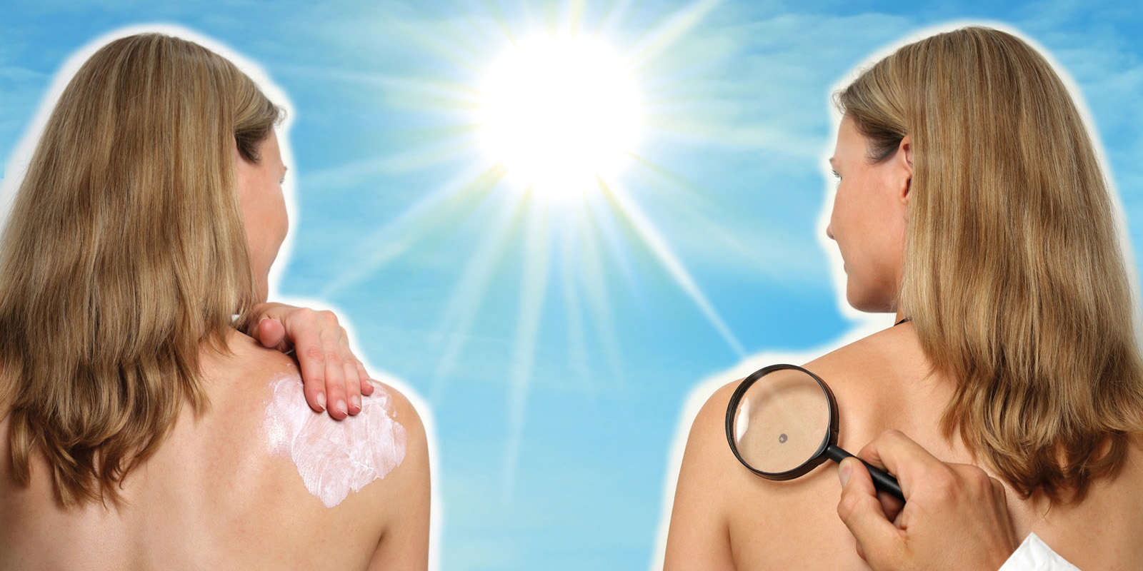 Zwei Frauen stehen nebeneinander. Eine cremt sich die Schulter ein, die andere wird auf der Schulter mit einer Lupe untersucht. Im Hintergrund scheint die Sonne.