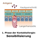 Wirkchanismus Kontaktallergie